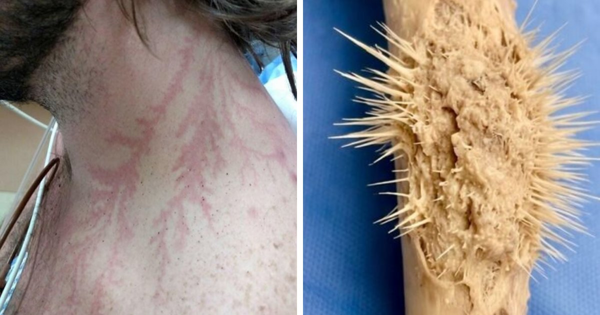 People Share 61 Photos Of The Unusual And Interesting Things That Happened To Their Bodies (New Pics)