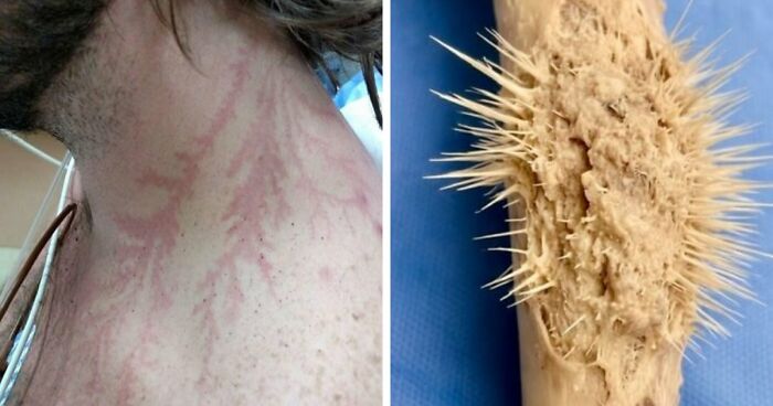 61 Interesting Photos Of Human Body Quirks That Are Both Fascinating And Shocking (New Pics)