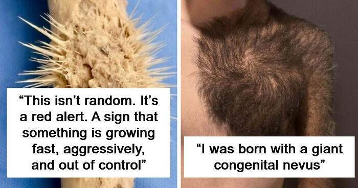 61 Interesting Photos Of Human Body Quirks That Are Both Fascinating And Shocking (New Pics)