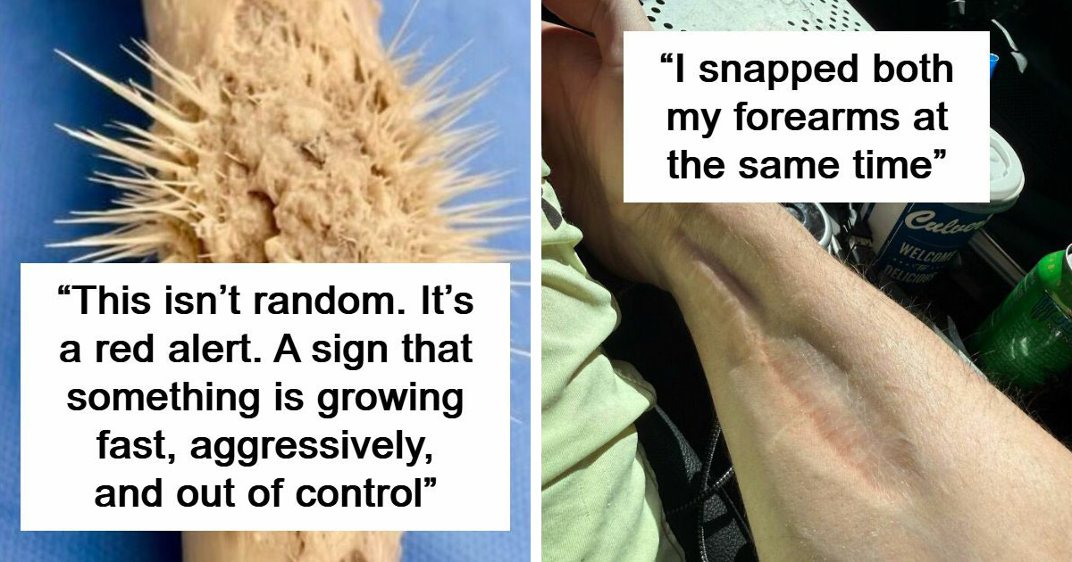 People Are Sharing How Weird Their Bodies Look Or Behave And These 61 Photos Are Fascinating (New Pics)