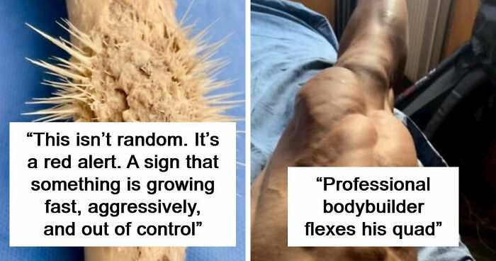 61 Interesting Photos Of Human Body Quirks That Are Both Fascinating And Shocking (New Pics)