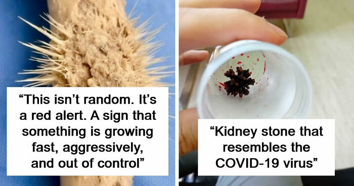 61 Interesting Photos Of Human Body Quirks That Are Both Fascinating And Shocking (New Pics)