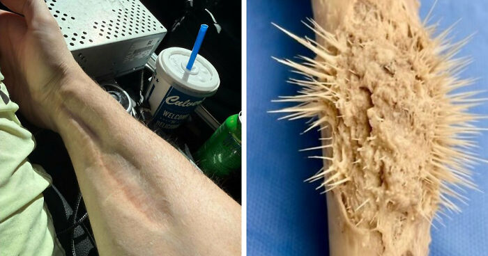 61 Interesting Photos Of Human Body Quirks That Are Both Fascinating And Shocking (New Pics)