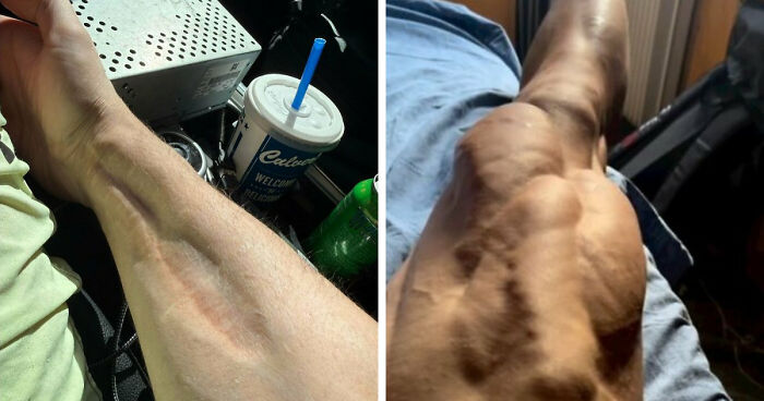 61 Interesting Photos Of Human Body Quirks That Are Both Fascinating And Shocking (New Pics)
