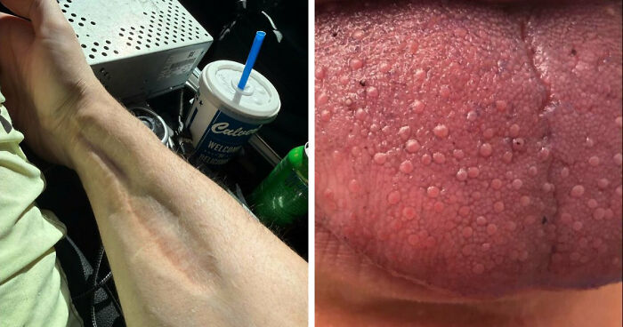 61 Interesting Photos Of Human Body Quirks That Are Both Fascinating And Shocking (New Pics)