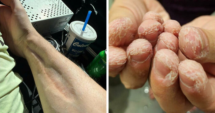 61 Interesting Photos Of Human Body Quirks That Are Both Fascinating And Shocking (New Pics)