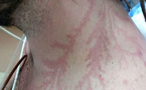 61 Interesting Photos Of Human Body Quirks That Are Both Fascinating And Shocking (New Pics)