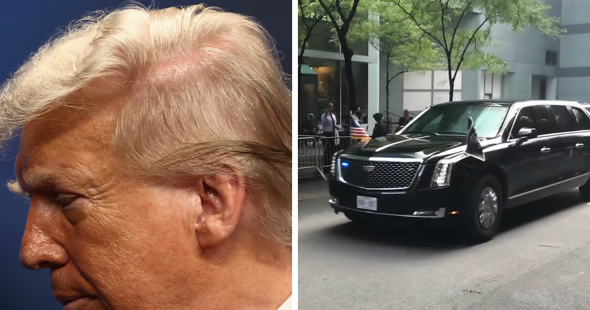 White House Accused Of Concealing Trump’s Medical History After Truth About Hair-Loss Treatment Discovered