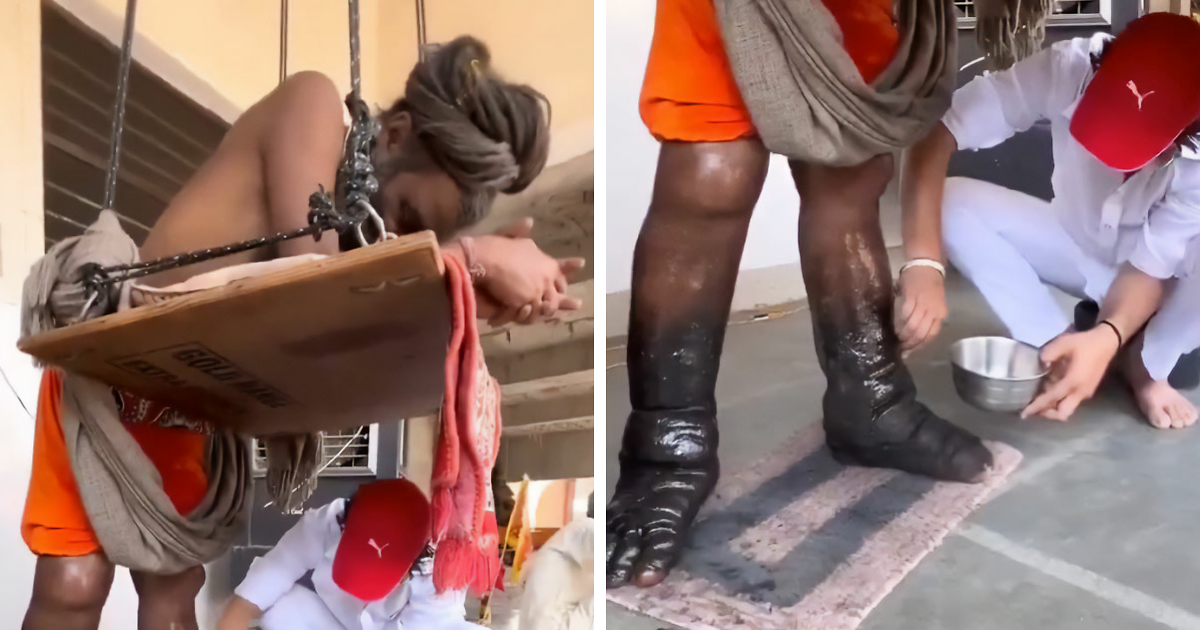Expert Explains Religious Ascetic's Feet As He Stands In The Same Place For 12 Years In Vow To God
