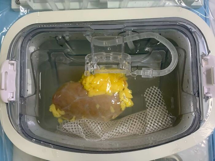 Human body quirks with an internal organ displayed in a medical device