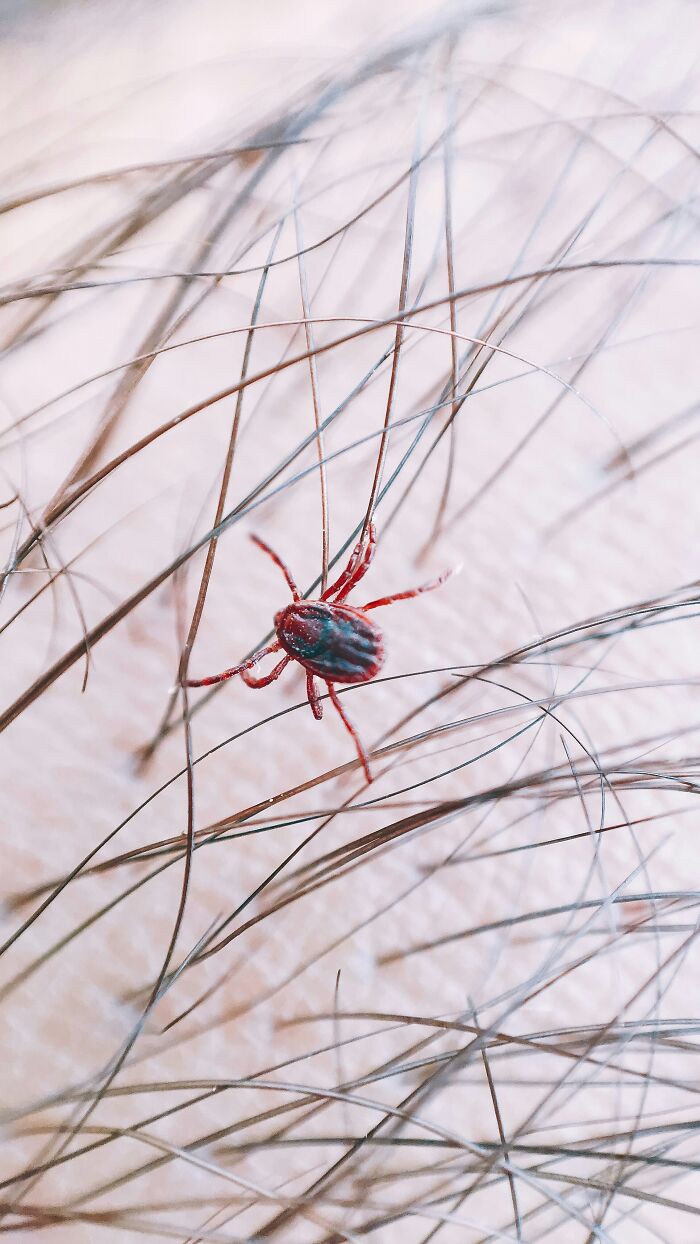 Close-up of tick on human skin with hair