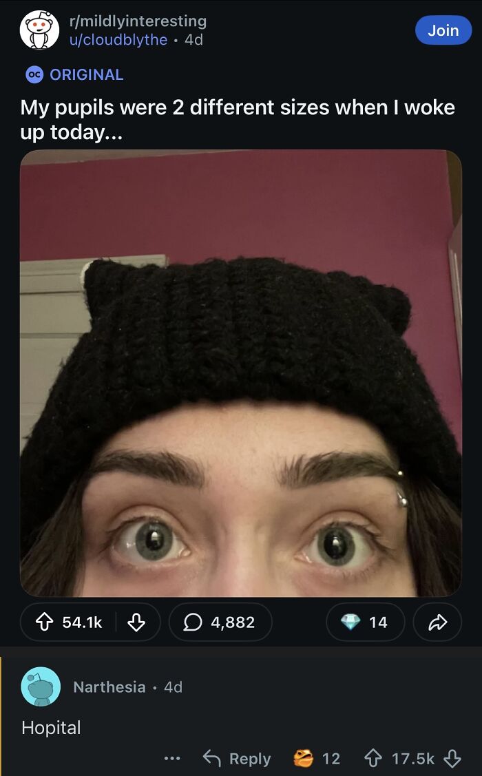 A funny image of a person with pupils of two different sizes, a truly broken sense of humor moment.