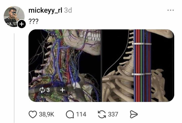 Medical illustration showing skeletal and vascular neck anatomy side by side