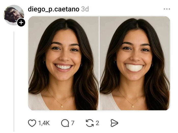 Side-by-side portraits of a woman smiling with normal and exaggerated teeth