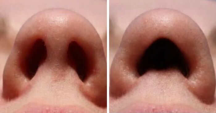 26 People Joined A Discussion About Nostrils, And Things Got Hilariously Weird Fast