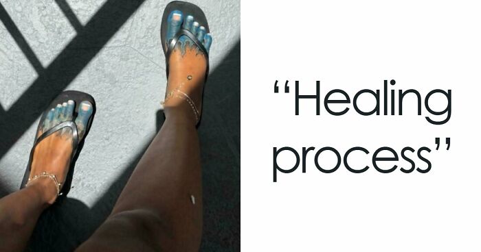 103 Tattoo Fails That Are Impossible To Ignore (New Pics)
