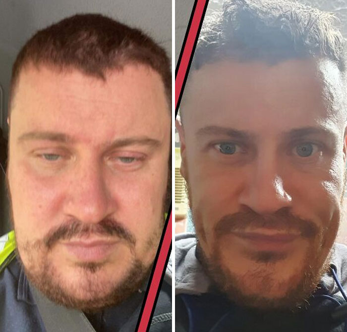 People left speechless at reunions: A man's impressive physical transformation shown in a before and after.