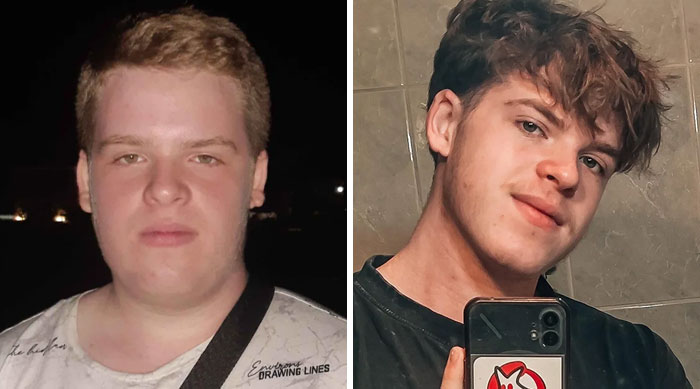 A young man's before and after photos display a remarkable change, leaving people speechless at reunions.
