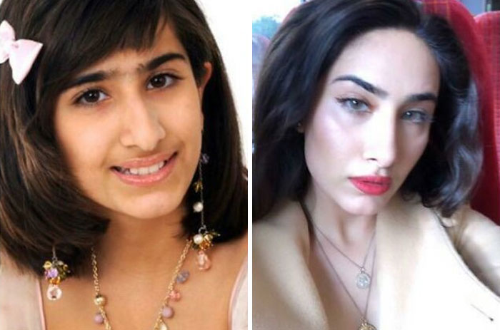 People left speechless at reunions: A young woman's dramatic before and after transformation, looking sophisticated.