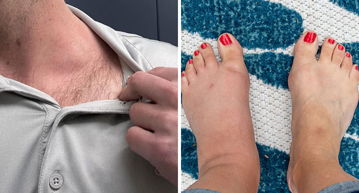 “He Thought It Was Just Getting Old”: 66 Medical Symptoms Doctors Wish More People Would Stop Ignoring