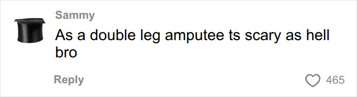 Comment about experience as a double leg amputee Comment about experience as a double leg amputee