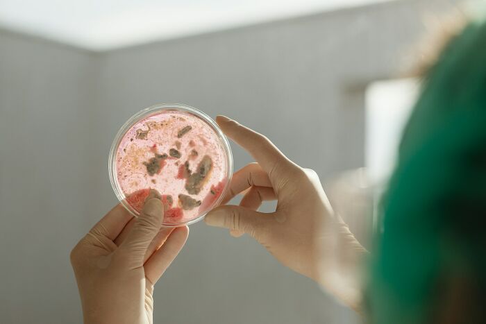Hands holding a petri dish with microbes for human body study