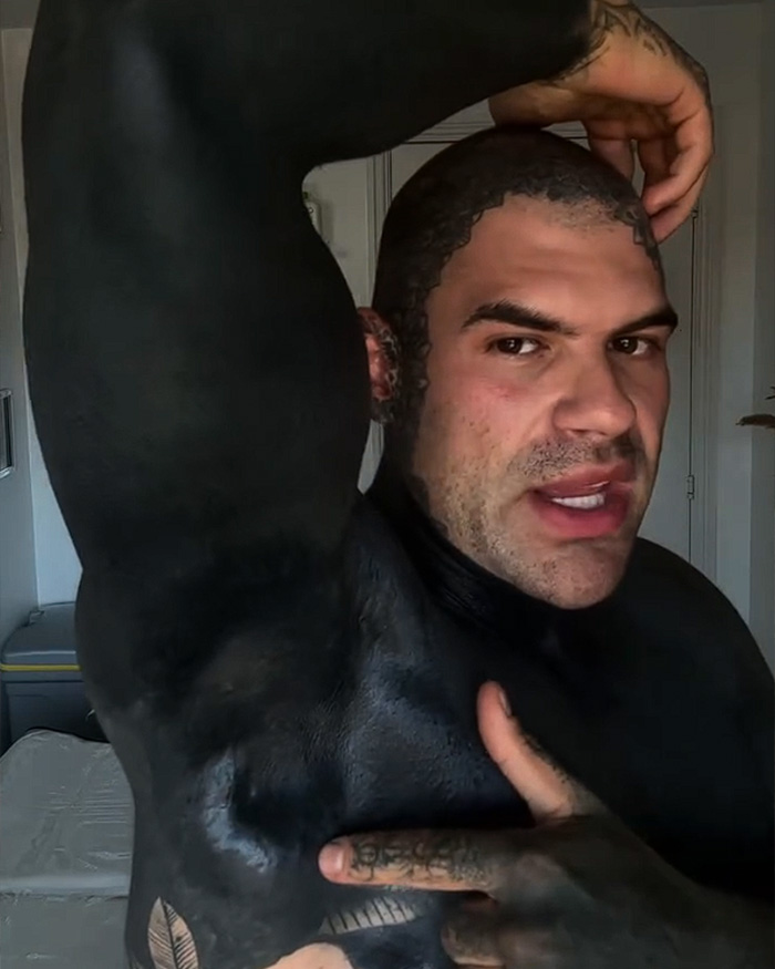 Man showing his arm and chest covered in blackout tattoos, posing for the camera with an intense expression.