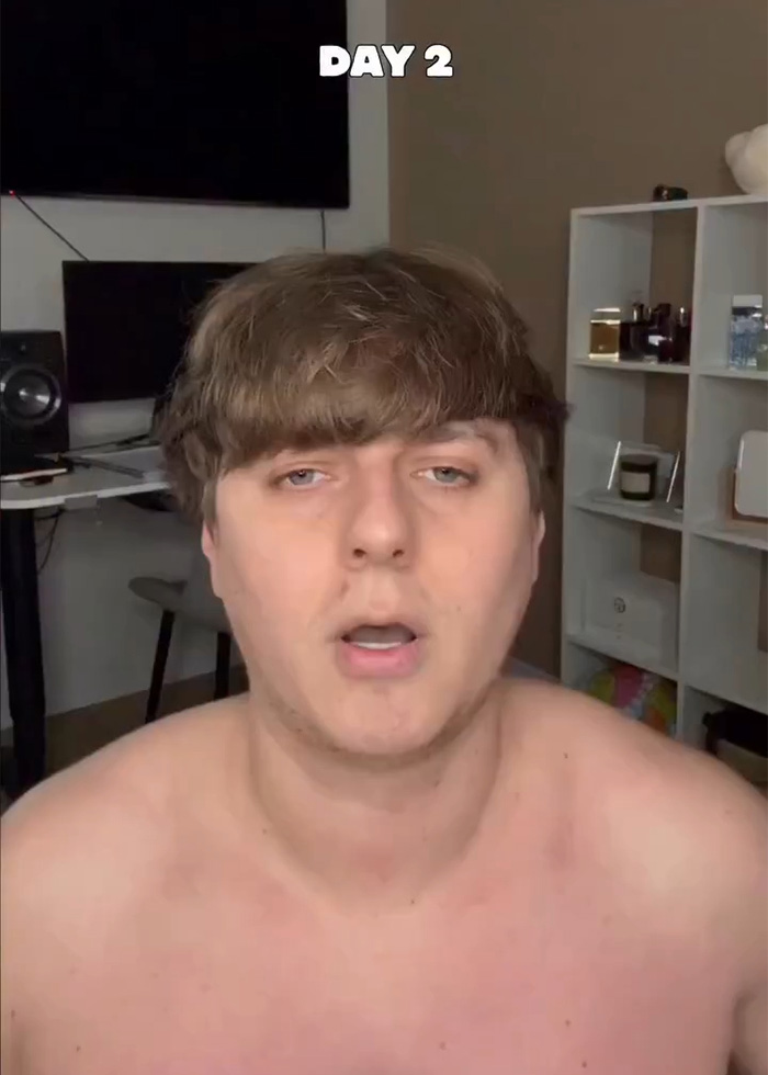 Man shows early results of jaw exercises on day 2 indoors
