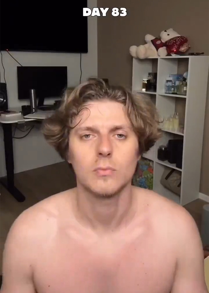 Man showing sharp jawline on day 83 after daily jaw exercises