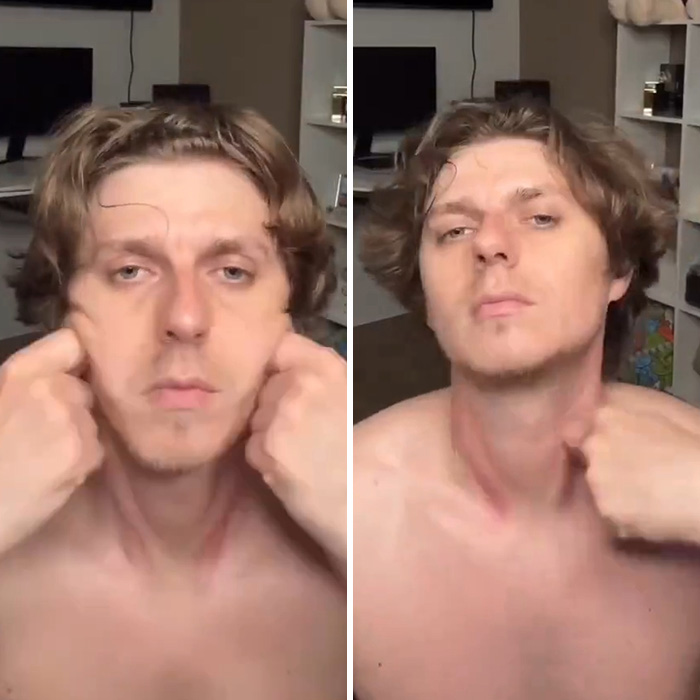 Man showing jaw exercise effect on jawline in 80-day transformation