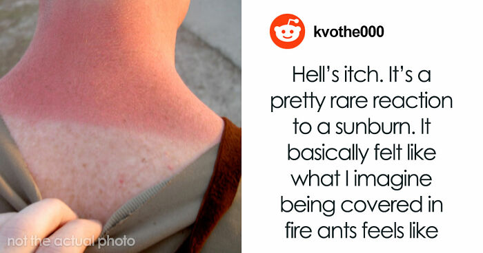 People Recount 49 Types Of Pain You Won’t Comprehend Until You’ve Suffered Through Them