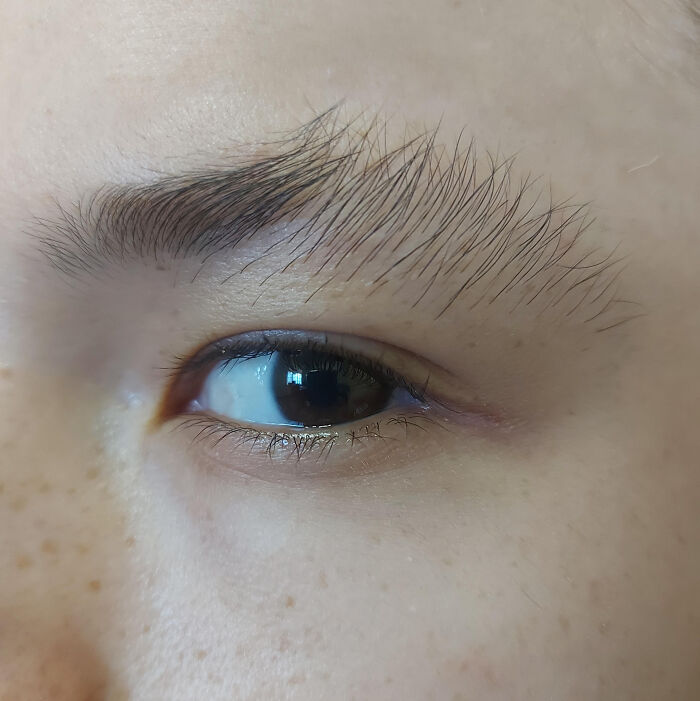 Close-up of eyebrow highlighting unique hair growth quirk