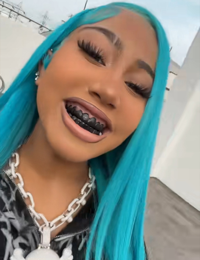 Person with blue hair smiling showing blackened teeth grill Person with blue hair smiling showing blackened teeth grill
