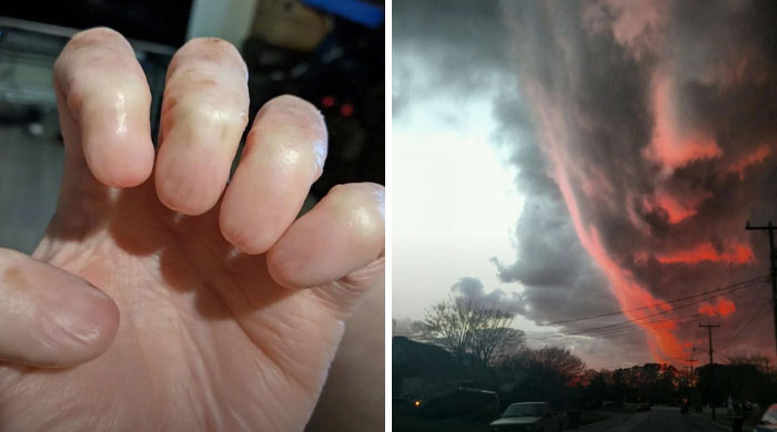 “Wife Hasn’t Eaten Eggs Since”: 83 Oddly Terrifying Images That Are Not For The Weak (New Pics)