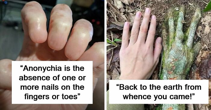 “Wife Hasn’t Eaten Eggs Since”: 83 Oddly Terrifying Images That Are Not For The Weak (New Pics)