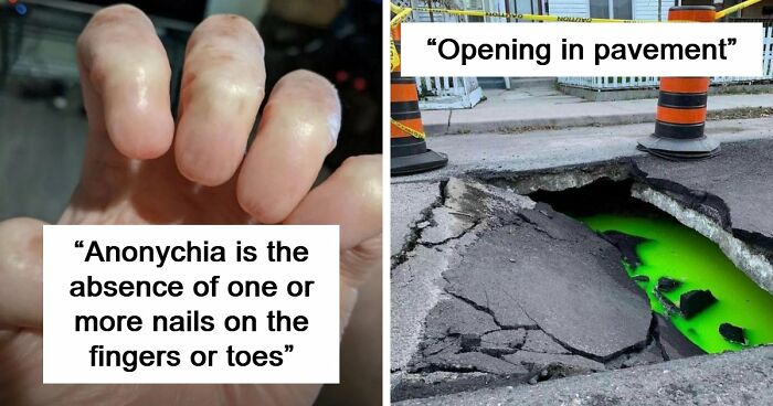 “Wife Hasn’t Eaten Eggs Since”: 83 Oddly Terrifying Images That Are Not For The Weak (New Pics)