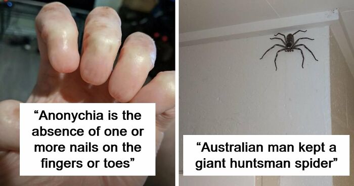 “Wife Hasn’t Eaten Eggs Since”: 83 Oddly Terrifying Images That Are Not For The Weak (New Pics)
