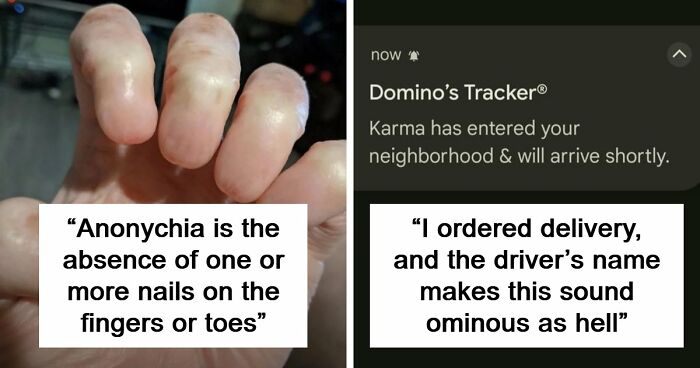 “Wife Hasn’t Eaten Eggs Since”: 83 Oddly Terrifying Images That Are Not For The Weak (New Pics)