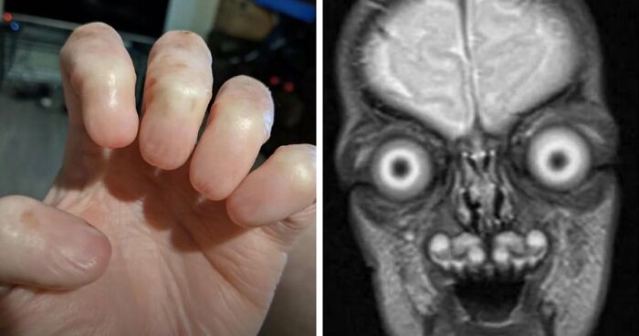“Wife Hasn’t Eaten Eggs Since”: 83 Oddly Terrifying Images That Are Not For The Weak (New Pics)