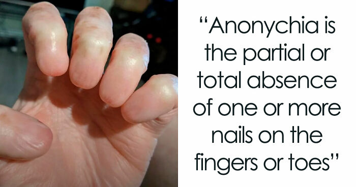 “Wife Hasn’t Eaten Eggs Since”: 83 Oddly Terrifying Images That Are Not For The Weak (New Pics)