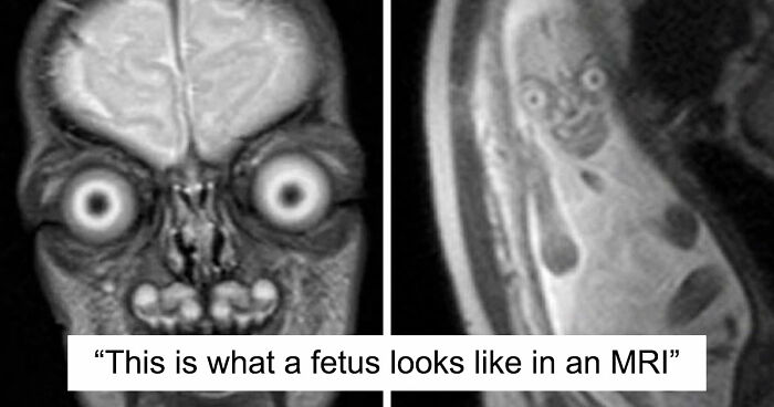 “Wife Hasn’t Eaten Eggs Since”: 83 Oddly Terrifying Images That Are Not For The Weak (New Pics)