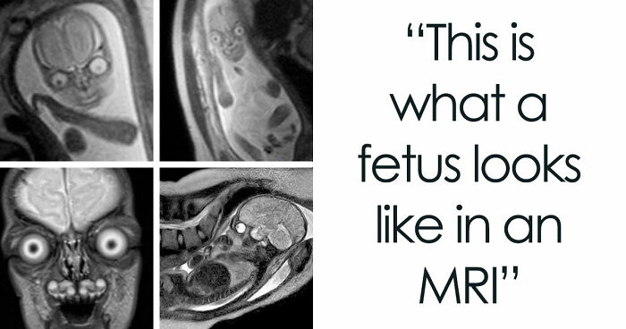 “Wife Hasn’t Eaten Eggs Since”: 83 Oddly Terrifying Images That Are Not For The Weak (New Pics)