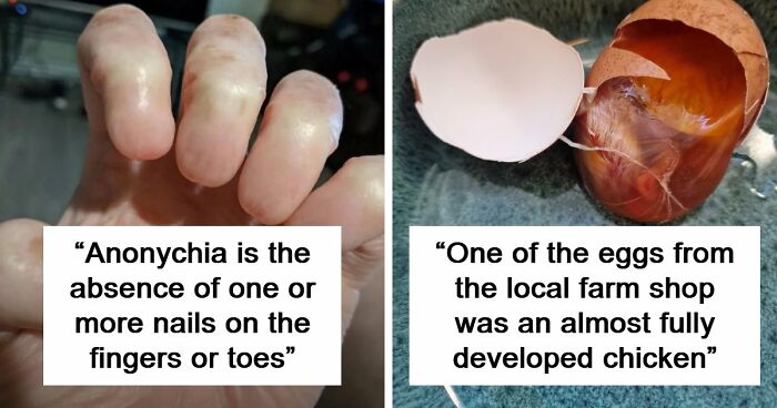 “Wife Hasn’t Eaten Eggs Since”: 83 Oddly Terrifying Images That Are Not For The Weak (New Pics)