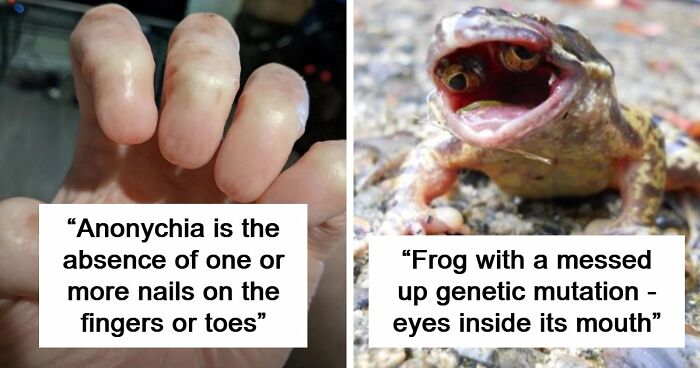 “Wife Hasn’t Eaten Eggs Since”: 83 Oddly Terrifying Images That Are Not For The Weak (New Pics)