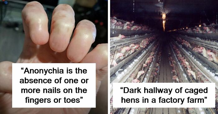 “Wife Hasn’t Eaten Eggs Since”: 83 Oddly Terrifying Images That Are Not For The Weak (New Pics)