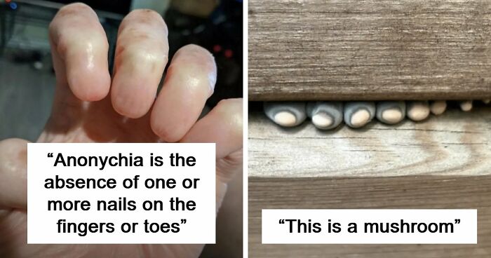 “Wife Hasn’t Eaten Eggs Since”: 83 Oddly Terrifying Images That Are Not For The Weak (New Pics)