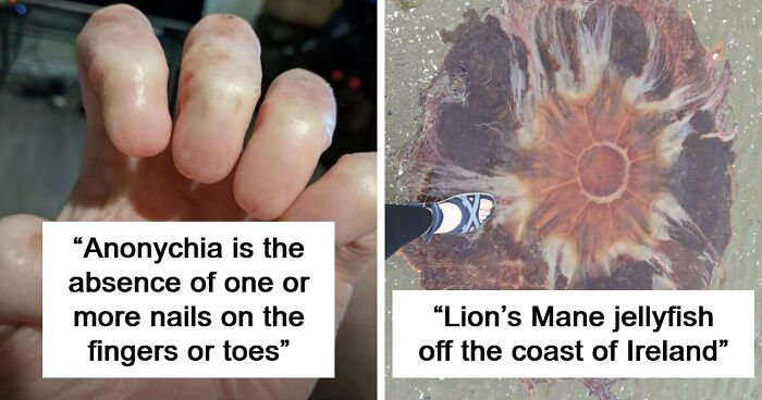 “Wife Hasn’t Eaten Eggs Since”: 83 Oddly Terrifying Images That Are Not For The Weak (New Pics)