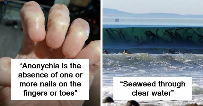 “Wife Hasn’t Eaten Eggs Since”: 83 Oddly Terrifying Images That Are Not For The Weak (New Pics)