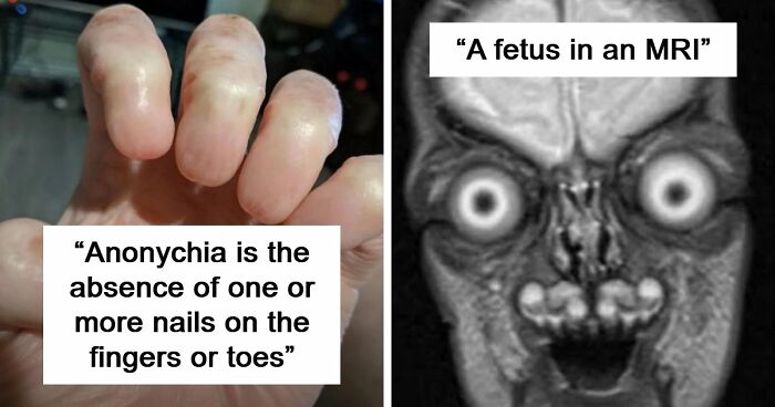 “Wife Hasn’t Eaten Eggs Since”: 83 Oddly Terrifying Images That Are Not For The Weak (New Pics)
