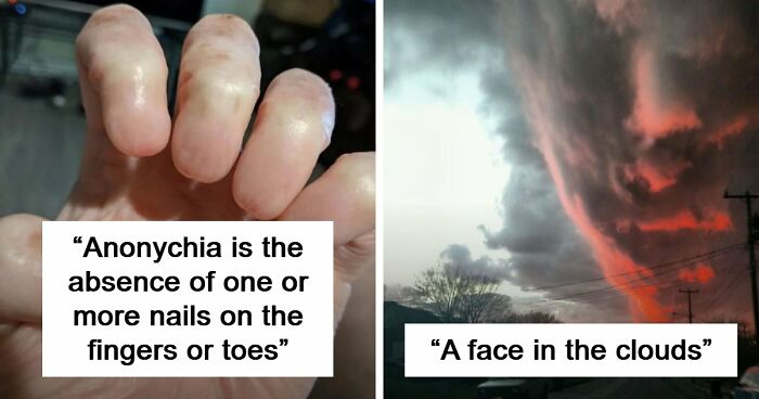 “Wife Hasn’t Eaten Eggs Since”: 83 Oddly Terrifying Images That Are Not For The Weak (New Pics)